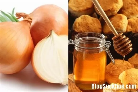 Phương pháp chữa u nang buồng trứng giai đoạn đầu