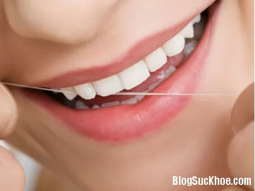 Lý do bác sĩ khuyên bạn nên sử dụng chỉ nha khoa