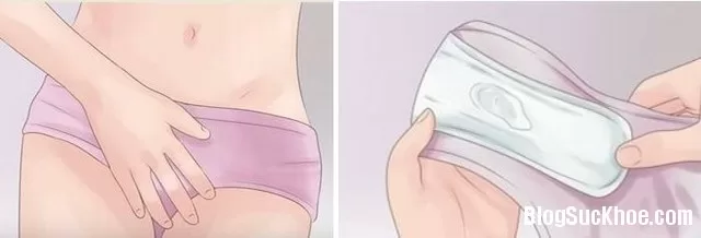 Những dấu hiệu chứng tỏ "vùng kín" không khỏe