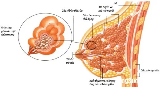 Các bệnh tuyến vú lành tính