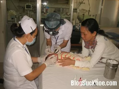 Xử trí bệnh mắt ở trẻ sơ sinh