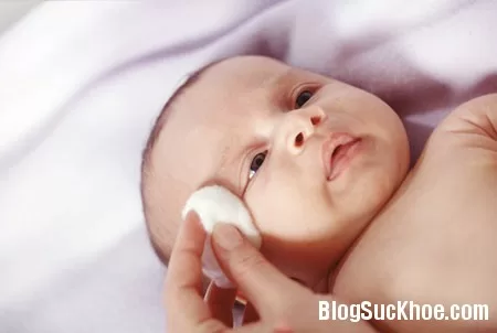 Chăm sóc mắt cho trẻ sơ sinh