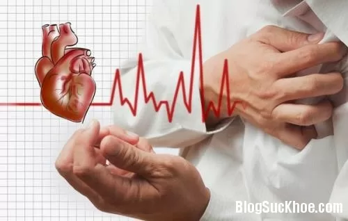 Điều trị hội chứng đánh trống ngực
