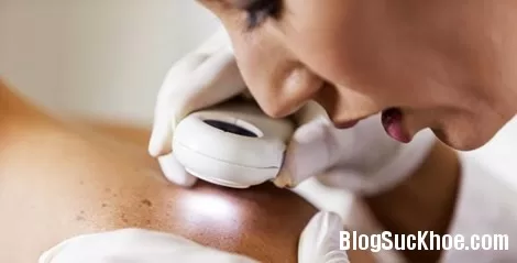 Những nguyên nhân ít ngờ gây bệnh cho da