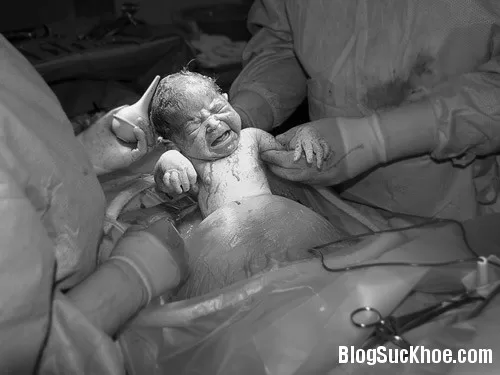 Bí quyết "nói không" với sinh mổ