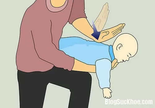 Cách xử trí khi trẻ bị sặc cháo, sặc sữa, sặc cơm
