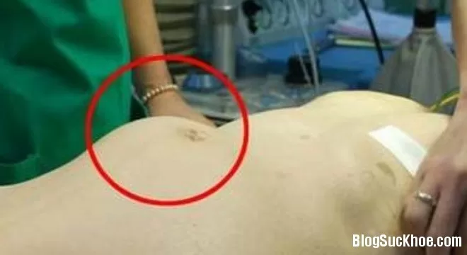 Những dấu hiệu "cái chết không hẹn trước"
