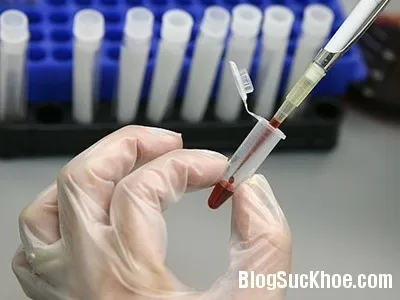 Trước khi đi xét nghiệm không nên uống thuốc