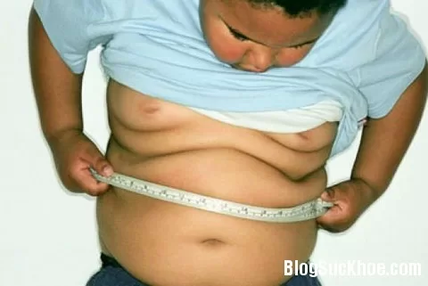 Chữa béo phì bằng bài thuốc Đông y