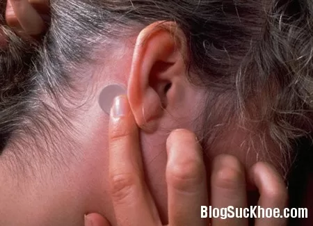 Những điều cần biết khi dùng miếng dán say tàu xe