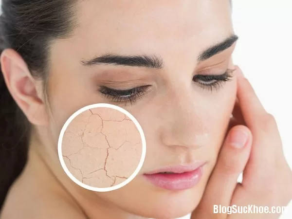"Biến" da khô trở nên mịn màng chỉ trong "nháy mắt"