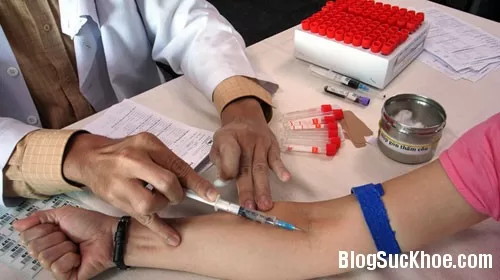 Xét nghiệm cholesterol