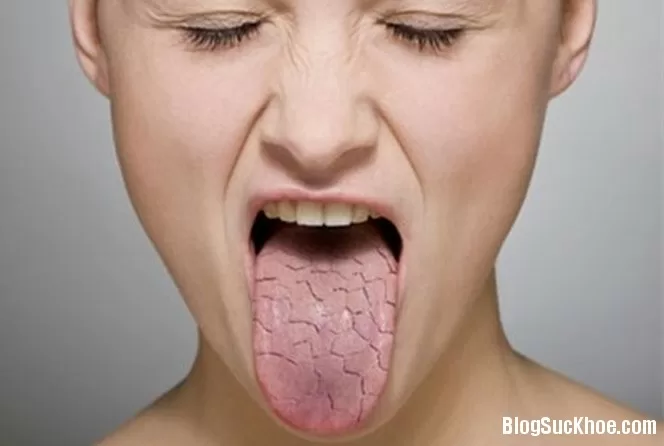 Những vị lạ ở miệng cảnh báo bệnh tật