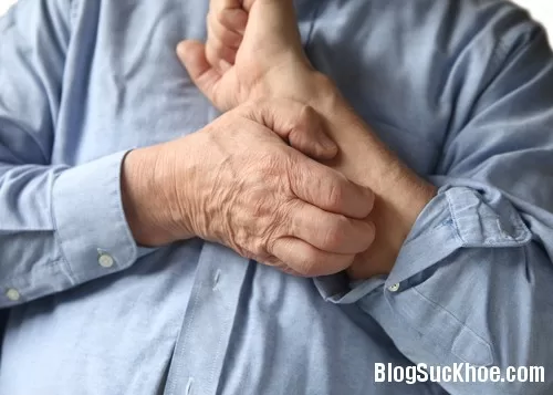 Một số bệnh ngoài da thường gặp ở người cao tuổi