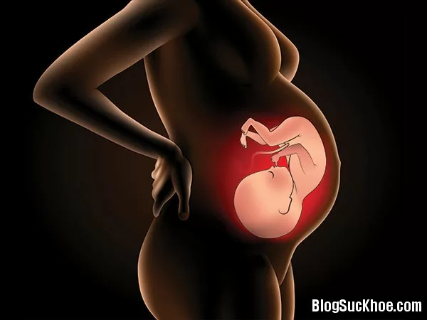 Những điều mẹ cần biết về thai chết lưu