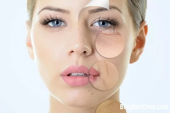 Mẹo đơn giản chữa làn da lão hóa