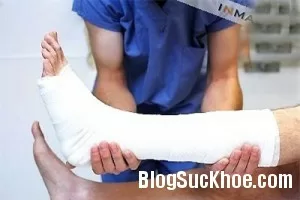 Phục hồi vận động sau bó bột đúng cách