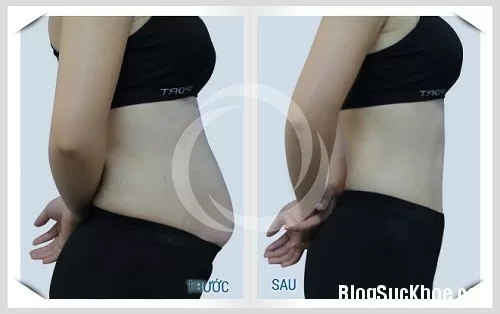 Diệt mỡ bụng dưới ngay tại nhà chỉ 1 tuần giảm 4cm