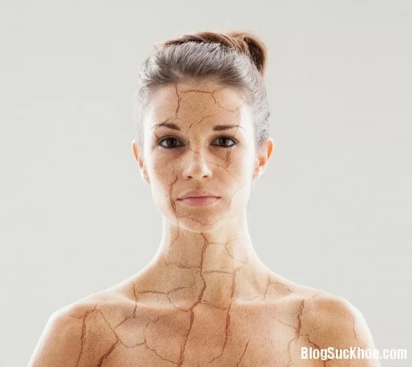 Biểu hiện cơ thể thiếu collagen