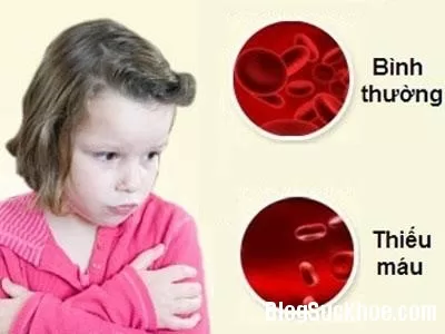 Món ăn - bài thuốc chữa bệnh thiếu máu