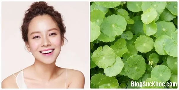 Hết sẹo rỗ ngay sau 1 tuần không để lại thâm nhờ rau má