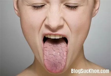 Cách bù nước cho cơ thể trong ngày nắng