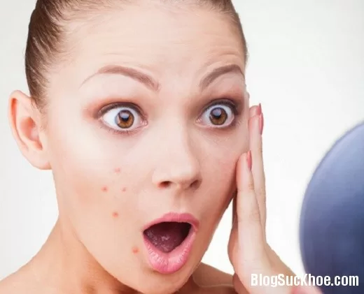 Làm mát cơ thể để không bị mọc mụn trứng cá
