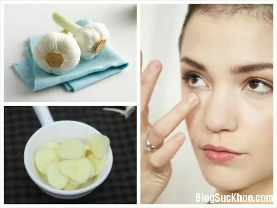 Hướng dẫn cách trị lỗ chân lông to