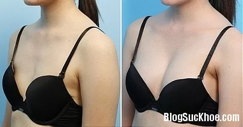 Thói quen hàng ngày khiến "vòng 1" xuống size