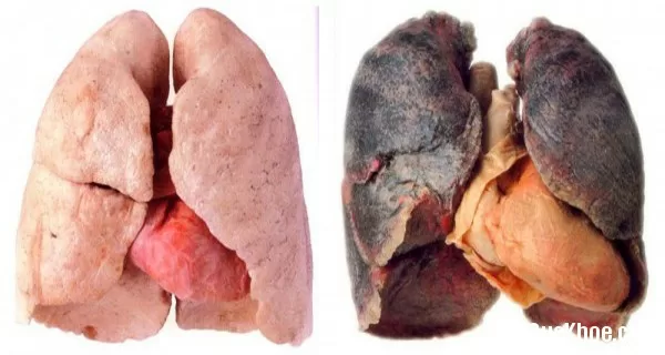 Nước uống thải độc phổi cho người hút thuốc lá