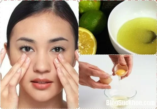 Công thức trắng da cực an toàn không bị dị ứng