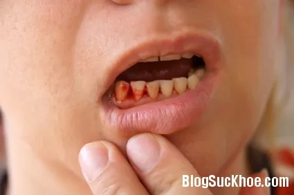 Dấu hiệu đơn giản nhận biết bệnh ung thư
