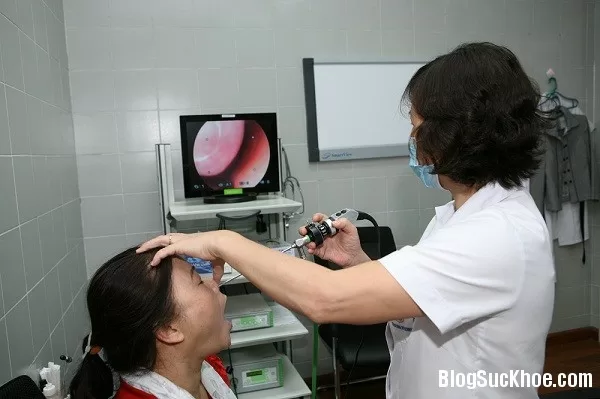 Bệnh viêm xoang cấp