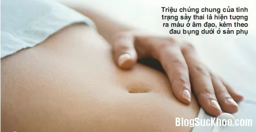 Các thể lâm sàng của biến cố sảy thai