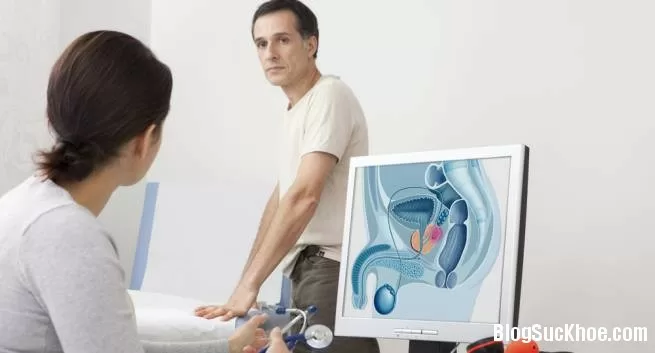 Khi nào cần phẫu thuật u xơ tuyến tiền liệt?