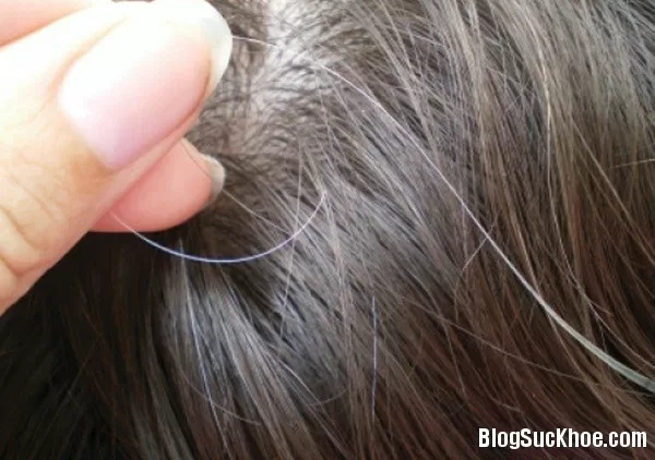 Cách giúp bạn không bị tóc bạc
