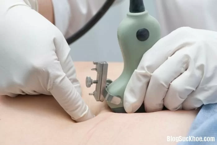 Bí quyết sinh con khỏe sau tuổi 35