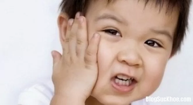 Dấu hiệu sớm và mẹo chữa bệnh quai bị nhanh khỏi