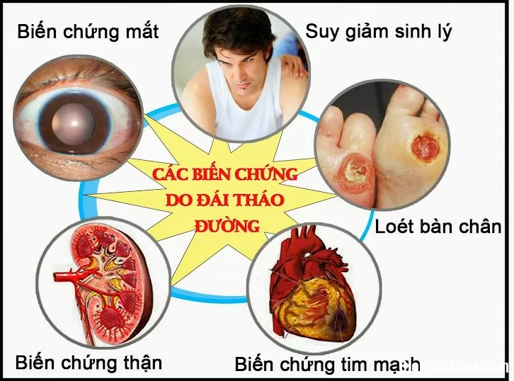 Triệu chứng và biến chứng bệnh đái tháo đường
