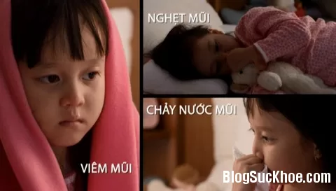 Nguyên nhân dẫn đến viêm xoang ở trẻ em
