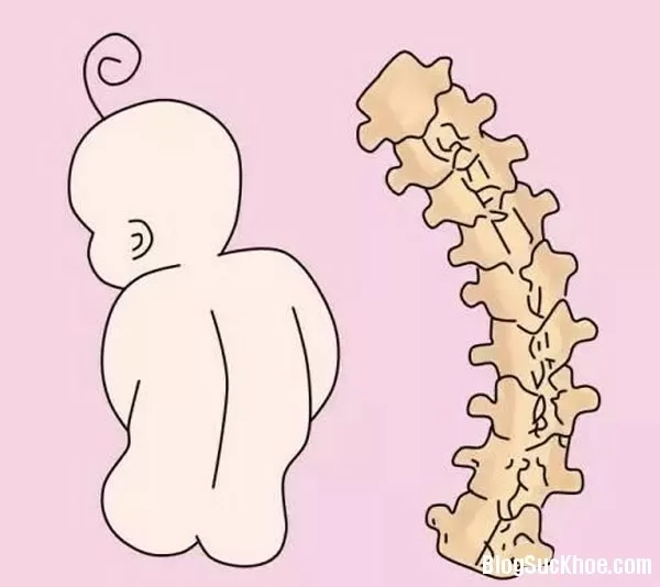 Những hành động của mẹ sẽ khiến bé gù lưng, cong vẹo cột sống