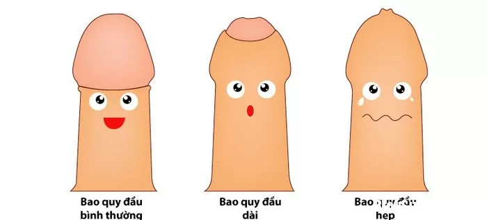 Có thực sự cần thiết cắt bao quy đầu cho trẻ?