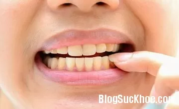 Tự làm trắng răng tại nhà vô cùng đơn giản