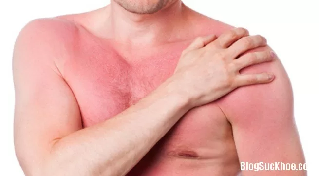 Biết điều này cả đời bạn không lo dị ứng