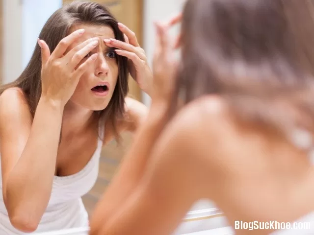 Mẹo giúp lỗ chân lông sạch thoáng và ngừa mụn