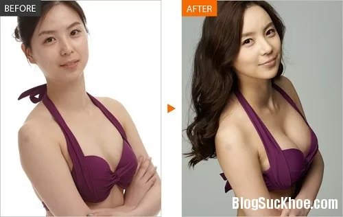 Công thức nở ngực hiệu quả chưa tới 5 nghìn đồng