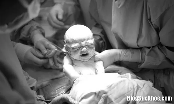 Kinh nghiệm mẹ cần phải biết trước khi đẻ mổ
