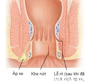 Khi bị ngứa chỗ "khó nói"