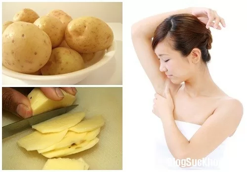 Mẹo biến nách thâm đen thành trắng mịn