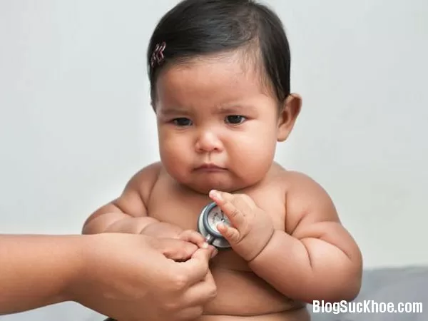 Dấu hiệu nhận biết trẻ béo phì